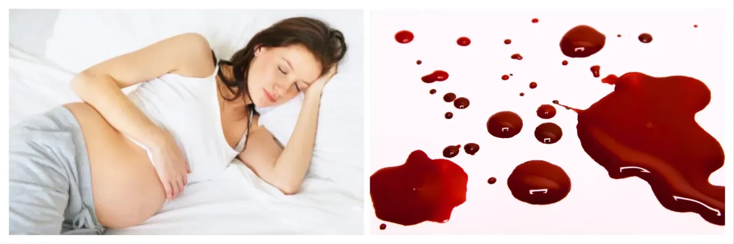 🩸 Mơ thấy máu chảy: Tai ương hay vận may đột phá sắp tới?