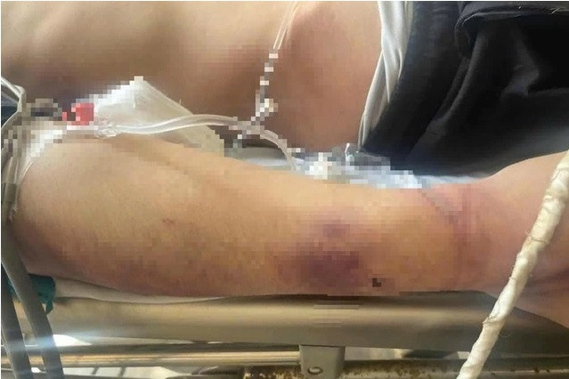 Click image for larger version

Name:	82-1767669177565-1767669177960660993089-1767690514122-17676905142561983651868.jpg
Views:	25
Size:	62.4 KB
ID:	56990